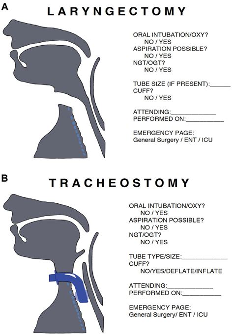 laryngectomy vula|post op laryngectomy nursing care.